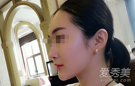 宋小宝朋友爆料视频,揭秘背后惊人真相! 第2张 宋小宝朋友爆料视频,揭秘背后惊人真相! 第2张